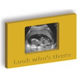 My First Picture - rámček na fotku z ultrazvuku - žltý - 1 ks